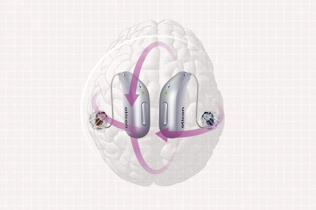 audición y cerebro